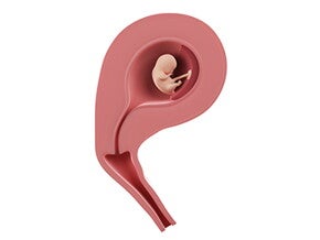 שבוע 10 להריון